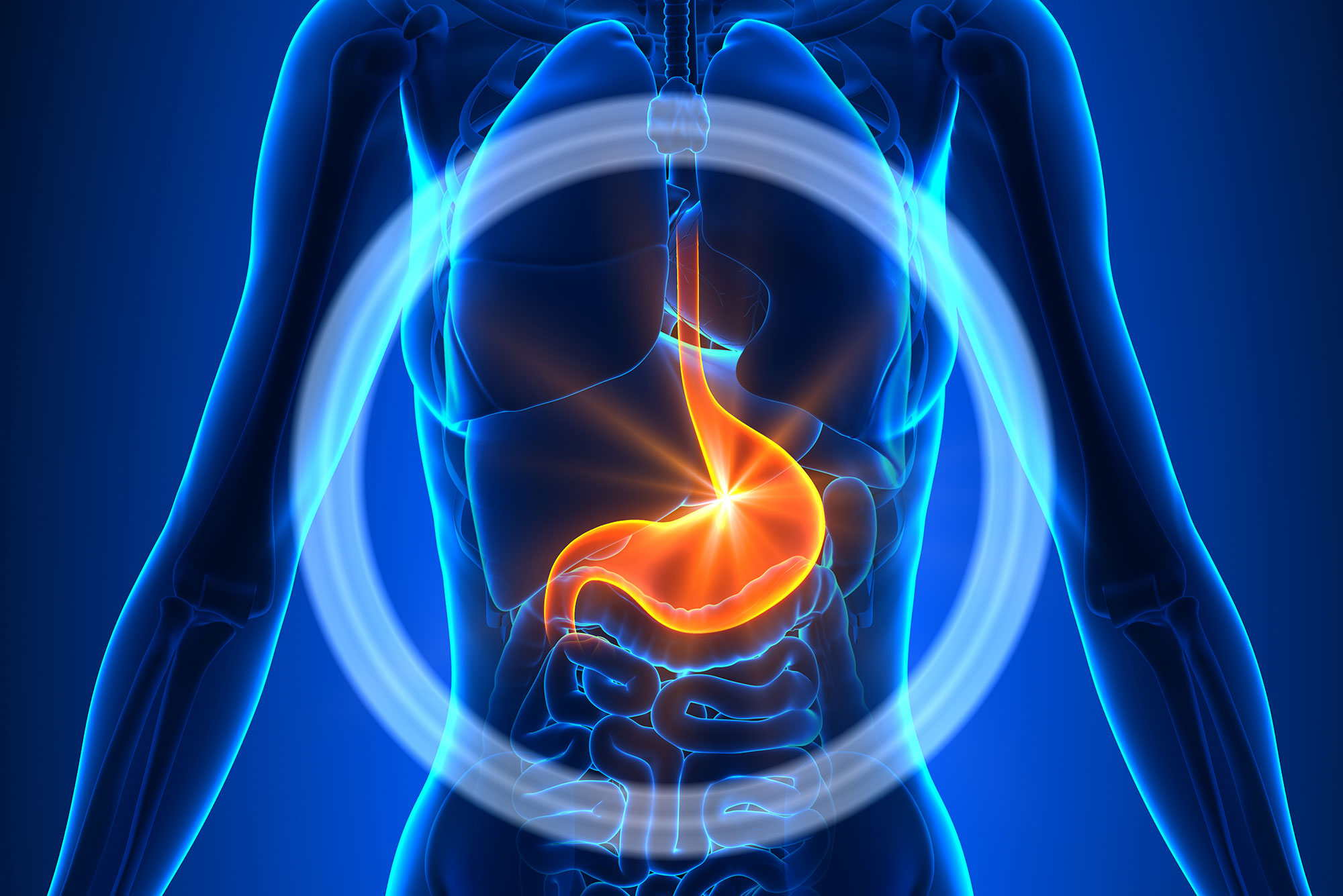 How Gut Inflammation Develops - Doctor's Nutrition